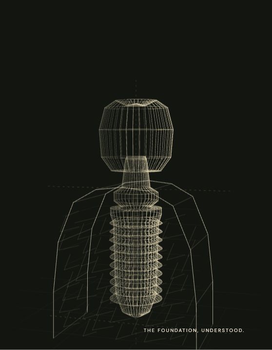 Approved REYES cross-section of an implant and supporting bone
